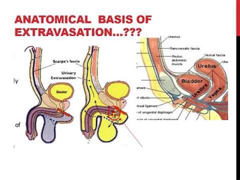 what is a gooch on the human body male|Perineum